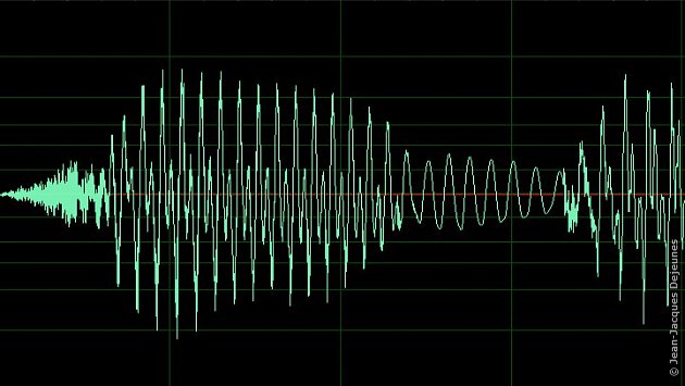 audiogramme - 1